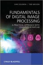 Fundamentals of Digital Image Processing – A Practical Approach with Examples in Matlab