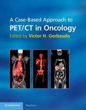 A Case-Based Approach to PET/CT in Oncology