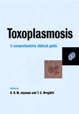 Toxoplasmosis: A Comprehensive Clinical Guide