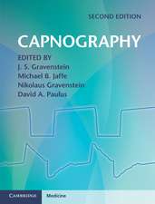 Capnography