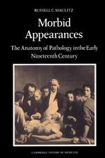 Morbid Appearances: The Anatomy of Pathology in the Early Nineteenth Century