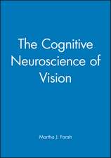 Cognitive Neuroscience Vision