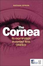 The Cornea: Its Examination in Contact Lens Practice