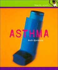 Asthma