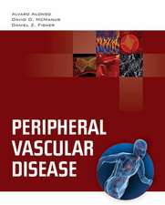 Peripheral Vascular Disease