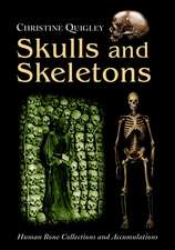 Skulls and Skeletons: Human Bone Collections and Accumulations