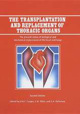 The Transplantation and Replacement of Thoracic Organs: The Present Status of Biological and Mechanical Replacement of the Heart and Lungs