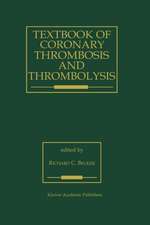 Textbook of Coronary Thrombosis and Thrombolysis