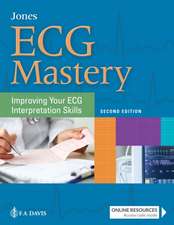 ECG Mastery