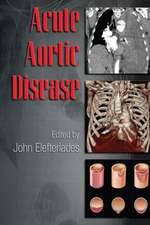 Acute Aortic Disease