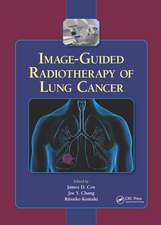 Image-Guided Radiotherapy of Lung Cancer