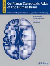 Co-Planar Stereotaxic Atlas of the Human Brain: 3-D Proportional System: An Approach to Cerebral Imaging