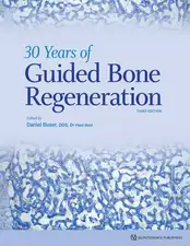 30 Years of Guided Bone Regeneration