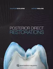 Posterior Direct Restorations