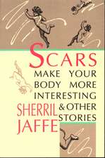 Scars Make Your Body More Interesting and Other Stories