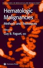 Hematologic Malignancies: Methods and Techniques