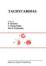 Tachycardias