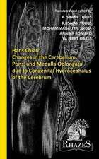 Changes in the Cerebellum, Pons, and Medulla Oblongata Due to Congenital Hydrocephalus of the Cerebrum