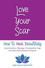 Love Your Scar: How to Heal Beautifully Using Nutrition, Massage, Homeopathy, Yoga and Many More Natural Therapies