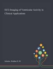 ECG Imaging of Ventricular Activity in Clinical Applications