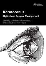 Keratoconus: Optical and Surgical Management