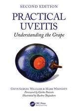 Practical Uveitis