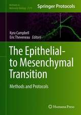 The Epithelial-to Mesenchymal Transition: Methods and Protocols