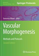 Vascular Morphogenesis: Methods and Protocols