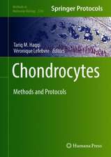 Chondrocytes: Methods and Protocols