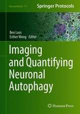 Imaging and Quantifying Neuronal Autophagy