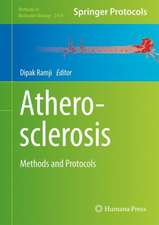 Atherosclerosis: Methods and Protocols