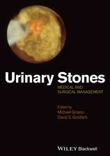 Urinary stones – Medical and Surgical Management