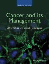 Cancer and its Management 7e