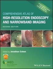 Comprehensive Atlas of High–Resolution Endoscopy and Narrowband Imaging