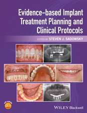 Evidence–based Implant Treatment Planning and Clinical Protocols