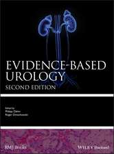 Evidence–based Urology 2e