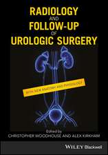 Radiology and Follow–up of Urologic Surgery