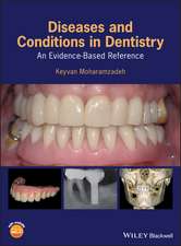 Diseases and Conditions in Dentistry – An Evidence–Based Reference