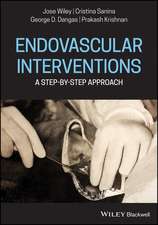 Endovascular Interventions – A Step–by–Step Approach