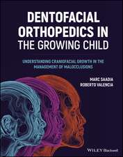 Dentofacial Orthopedics in the Growing Child – Understanding Craniofacial Growth in the Management of Malocclusions