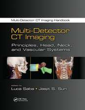 Multi-Detector CT Imaging: Principles, Head, Neck, and Vascular Systems