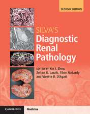 Silva's Diagnostic Renal Pathology