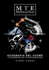 Ecografia del Cuore - Myeasytest