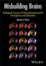 Misbuilding Brains