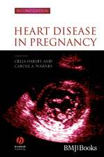 Heart Disease in Pregnancy 2e