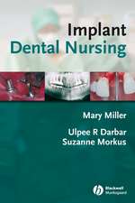 Implant Dental Nursing