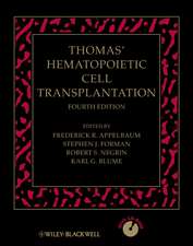 Thomas′ Hematopoietic Cell Transplantation