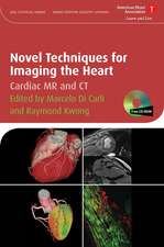 Novel Techniques for Imaging the Heart – Cardiac MR and CT