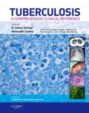 Tuberculosis