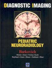 Diagnostic Imaging: Pediatric Neuroradiology